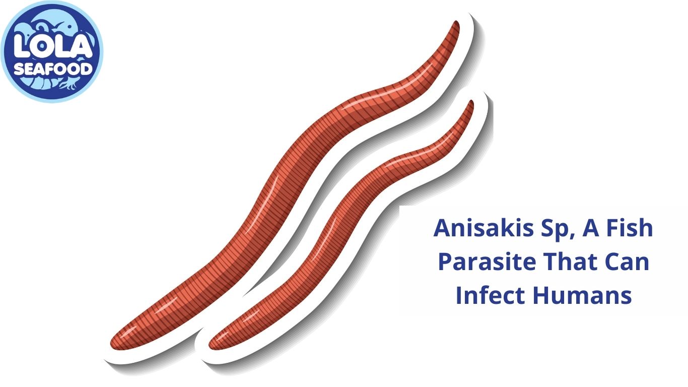 Anisakis Sp, A Fish Parasite That Can Infect Humans